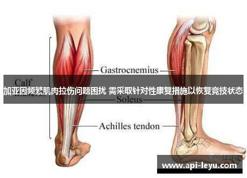 加亚因频繁肌肉拉伤问题困扰 需采取针对性康复措施以恢复竞技状态
